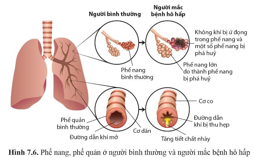 Sinh 11 Cánh diều Bài 7: Hô hấp ở động vật