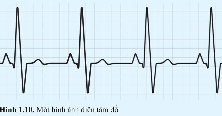 Vật Lí 11 Cánh diều Bài 1: Dao động điều hoà